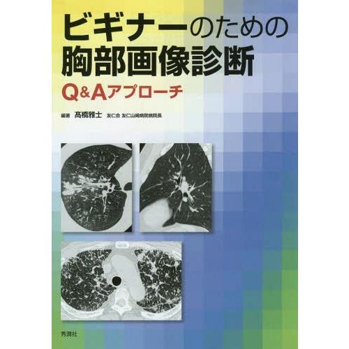 ビギナーのための胸部画像診断 Q Aアプローチ