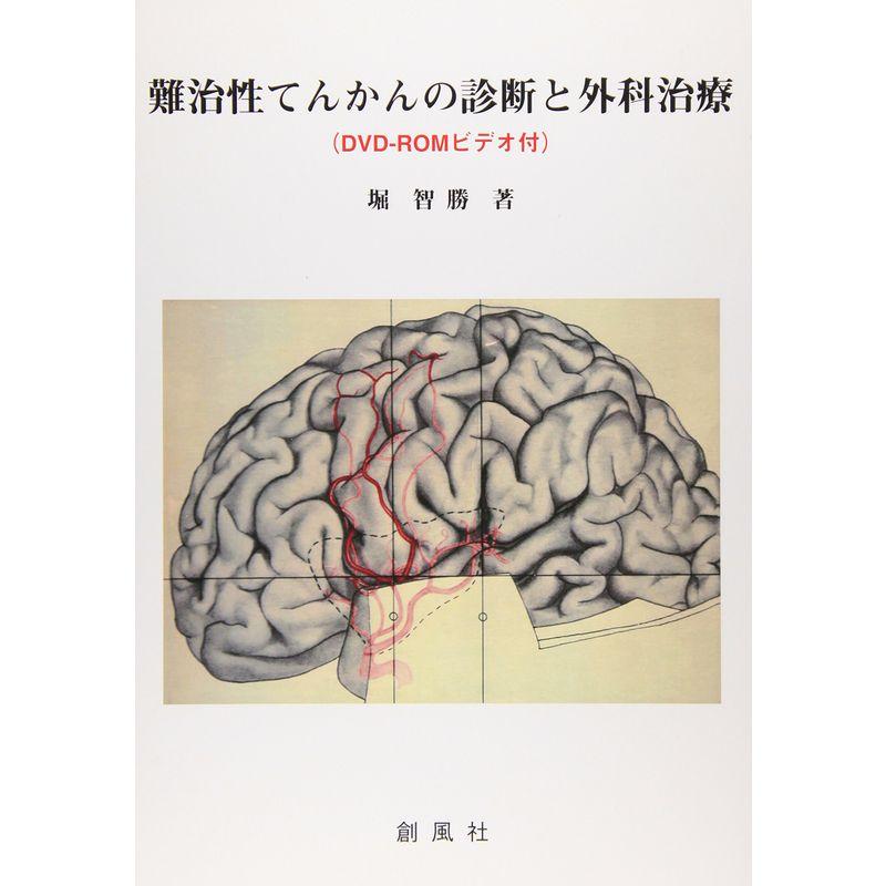 難治性てんかんの診断と外科治療