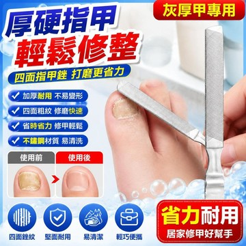 免運🚀便攜指甲銼 打磨條 厚硬腳趾甲灰修指甲銼 磨修甲器 美甲 去死皮 指甲銼