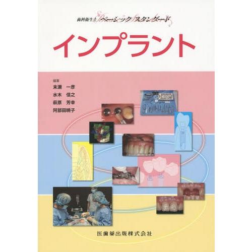 歯科衛生士ベーシックスタンダード インプラント