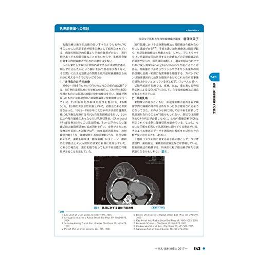 がん・放射線療法2017