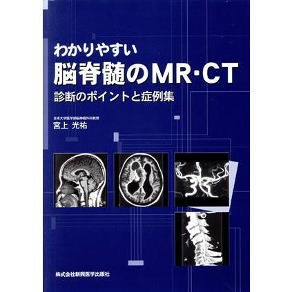 わかりやすい脳脊髄のＭＲ・ＣＴ 診断のポイントと症例集／宮上光祐