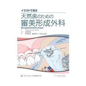 イラストで見る 天然歯のための審美形成外科