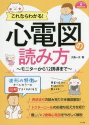 これならわかる 心電図の読み方 モニターから12誘導まで