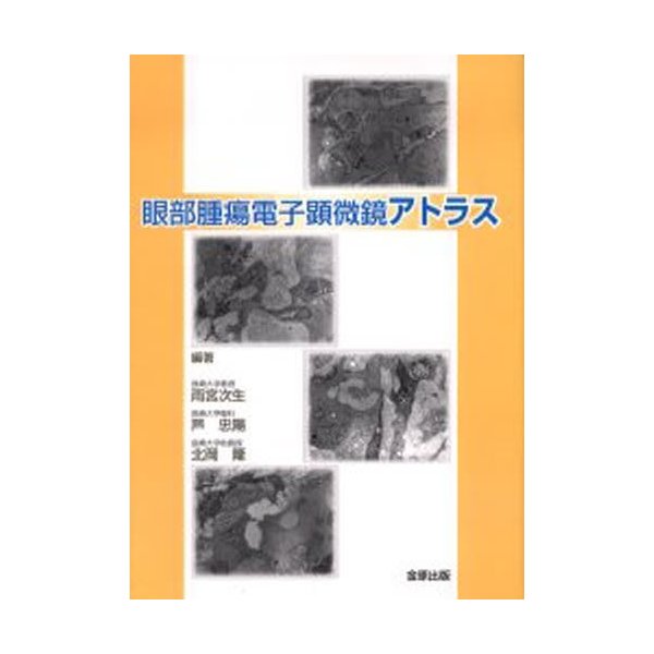 眼部腫瘍電子顕微鏡アトラス