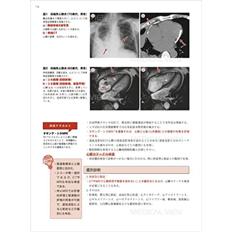 心臓・大血管 画像診断の勘ドコロNEO