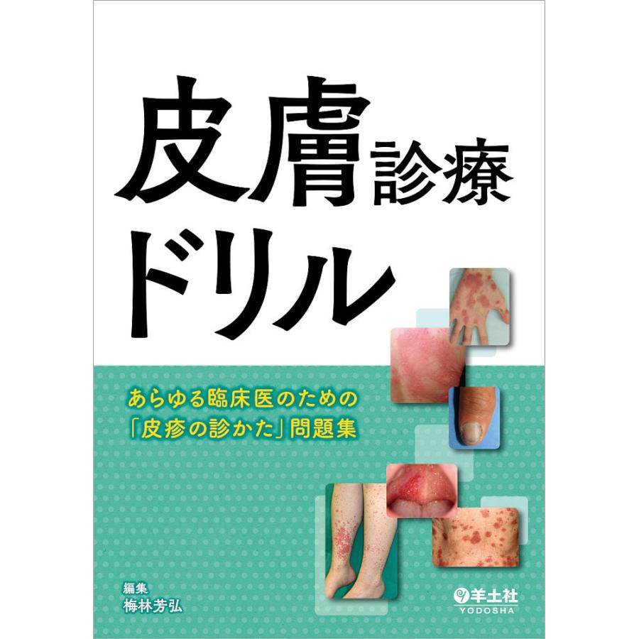 皮膚診療ドリル~あらゆる臨床医のための 皮疹の診かた 問題集