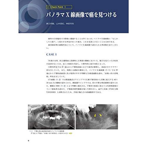 歯科臨床画像診断のチェックポイント