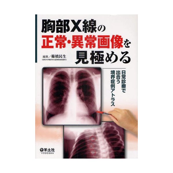 胸部X線の正常・異常画像を見極める 日常診療で出合う境界症例アトラス