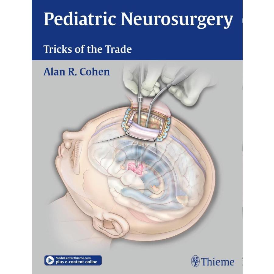 Pediatric Neurosurgery: Tricks of the Trade