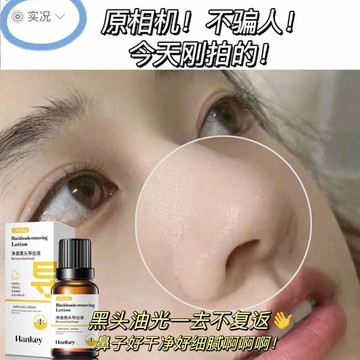 斷貨王🔴凈澈黑頭導出液 去黑頭 白頭 粉刺 閉口 痘痘 精華液 粉刺護理 淨透毛孔 收縮毛孔 男女通用 精華水 肌膚保養
