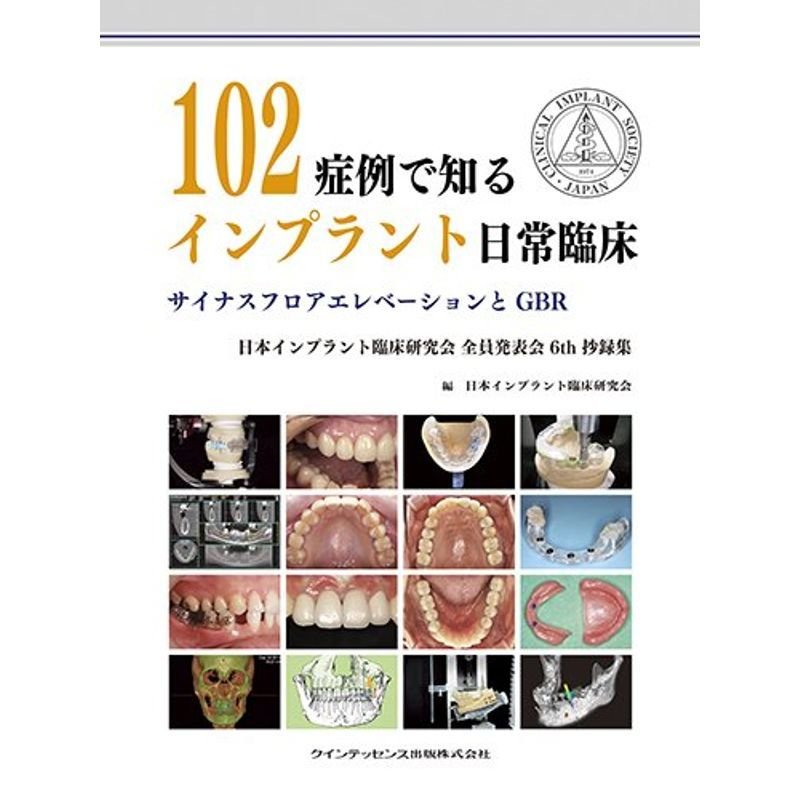 102症例で知るインプラント日常臨床