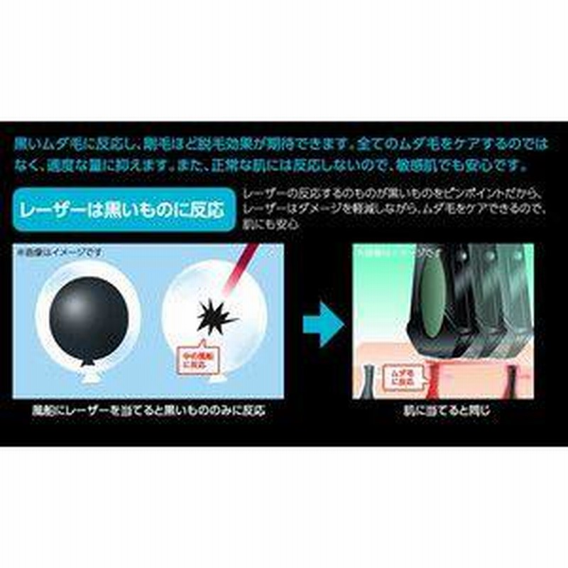 YA-MAN ヤーマン モバイルレーザー HD16-1-8A 男性レーザー脱毛 YA-MAN ヤーマン モバイルレーザー HD16-1-8A 男性レーザー脱毛