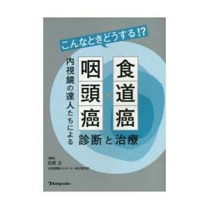 こんなときどうする 食道癌・咽頭癌 内視鏡の達人たちによる診断と治療