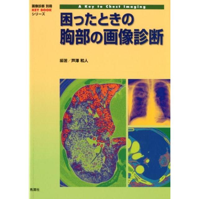 困ったときの胸部の画像診断