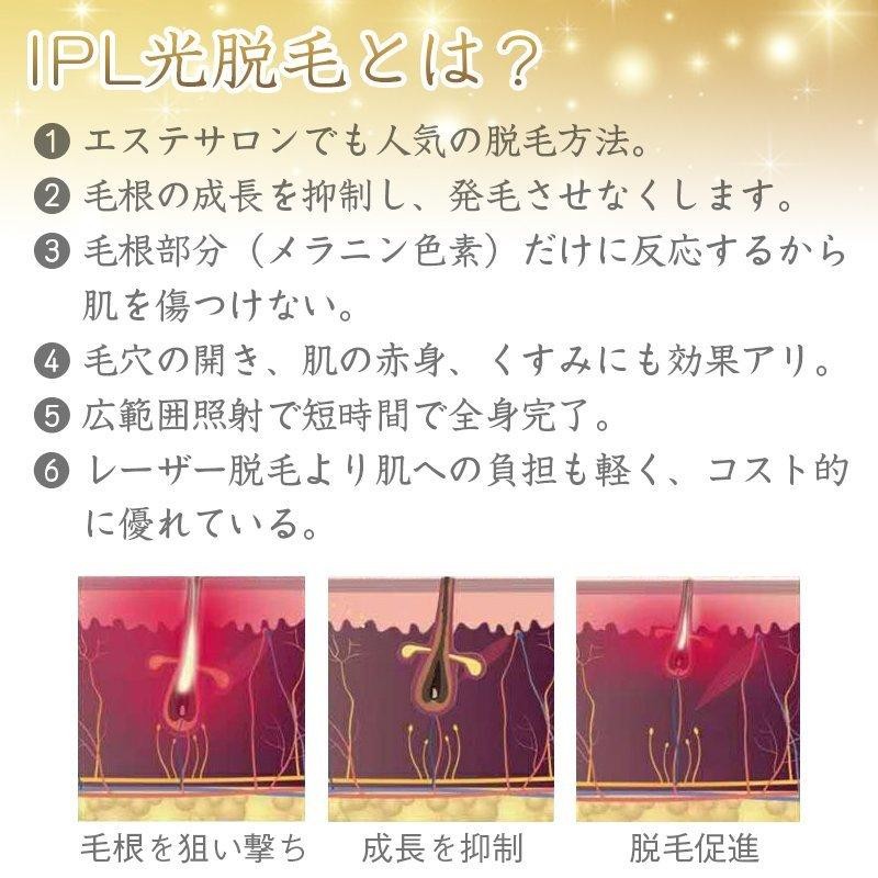 SALE IPL光脱毛器 強力 VIO 冷却 100万発 1年保証 フラッシュ 痛くない ...