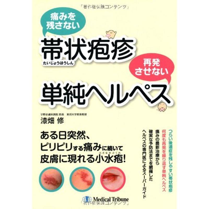 痛みを残さない帯状疱疹 再発させない単純ヘルペス