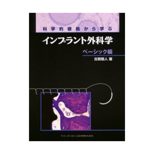 科学的根拠から学ぶインプラント外科学 ベーシック編