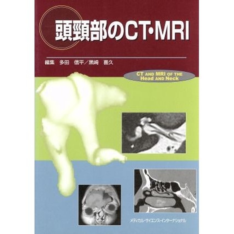 頭頸部のCT・MRI - 参考書