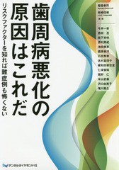 歯周病悪化の原因はこれだ リスクファクターを知れば難症例も怖くない