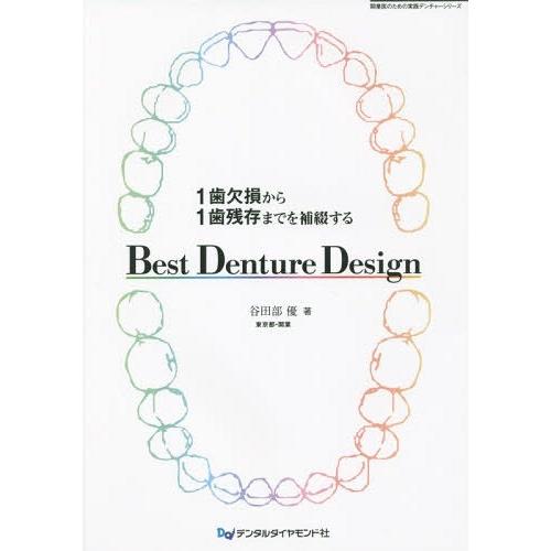 1歯欠損から1歯残存までを補綴するBest Denture Design