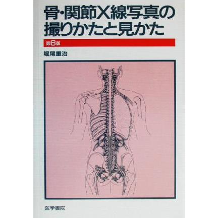 骨・関節Ｘ線写真の撮りかたと見かた／堀尾重治(著者)