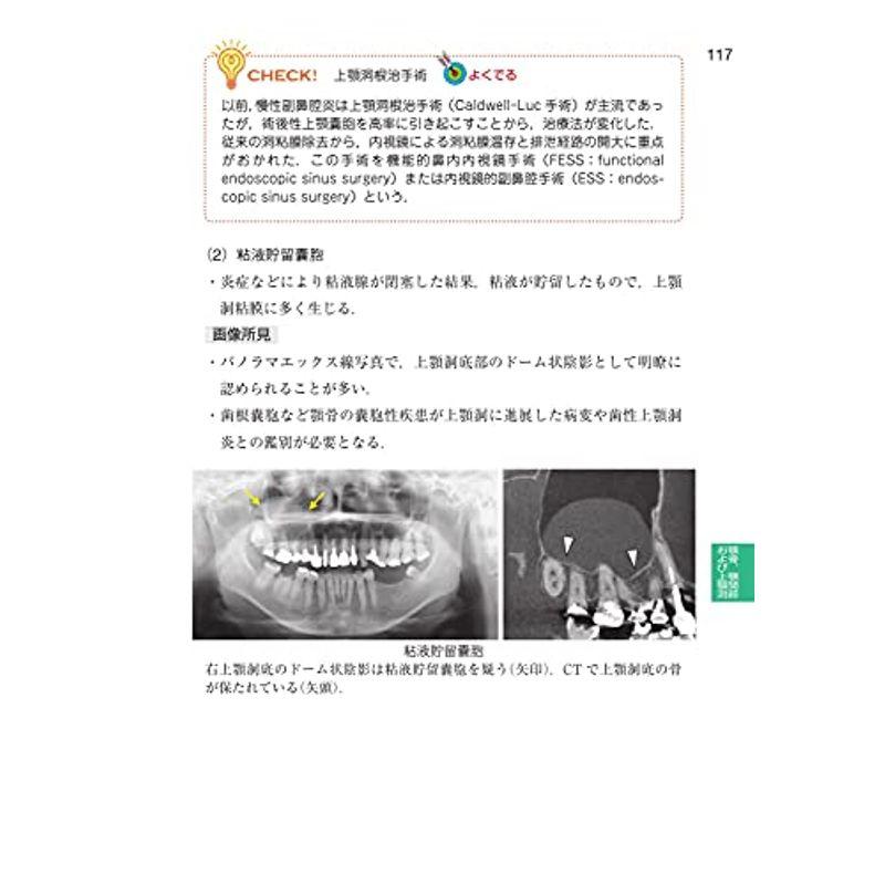 歯科国試パーフェクトマスター 歯科放射線学