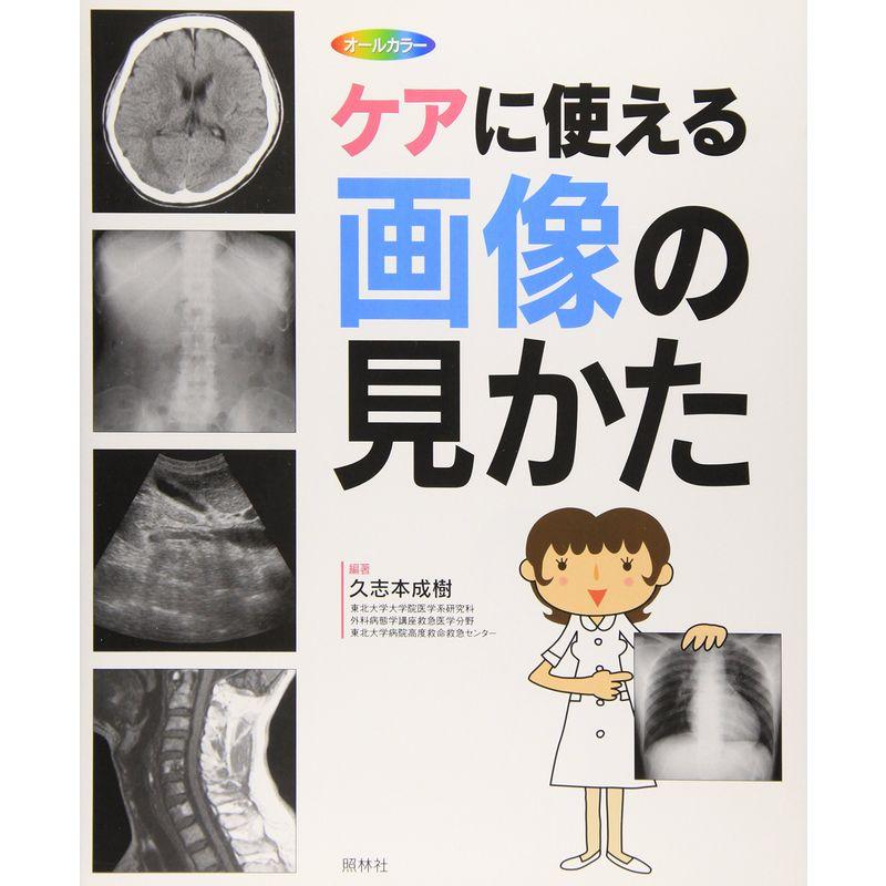 ケアに使える画像の見かた X線写真・CT画像・エコー像・MRI