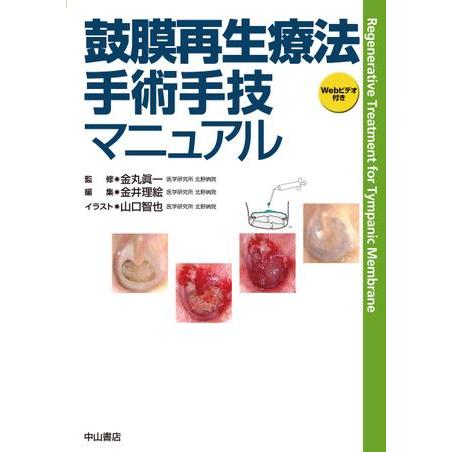 鼓膜再生療法 手術手技マニュアル