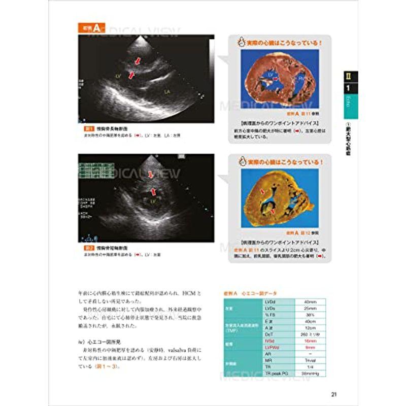 心エコー図検査に役立つ ヒト心臓形態のすべて