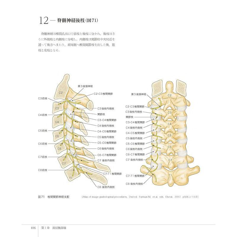 脊椎エコーのすべて 頚肩腕部・腰殿部痛治療のために -SONOANATOMY, TARGET and INTERVENTION-
