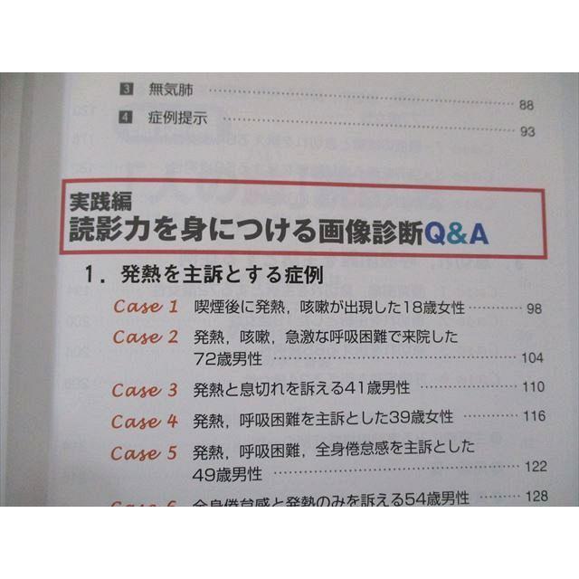 UW81-283 羊土社 見逃しなく読める!胸部X線画像診断QA―「人の肺」読影法と症例演習 11m3C