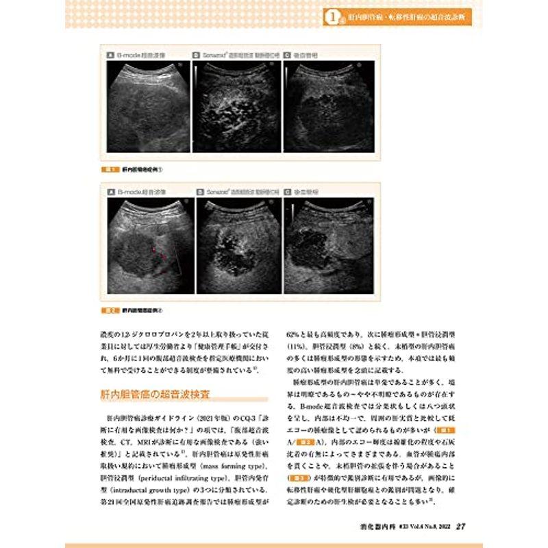 消化器内科 第33号(Vol.4 No.8,2022)特集:肝疾患における画像診断の進歩 ?腹部超音波,CT,MRI?