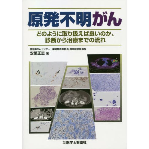 原発不明がん どのように取り扱えば良いのか,診断から治療までの流れ