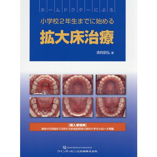 ホームドクターによる小学校2年生までに始める拡大床治療 須貝昭弘