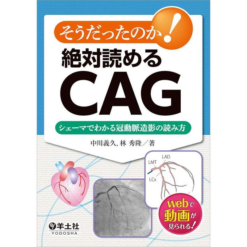 そうだったのか 絶対読めるCAG~シェーマでわかる冠動脈造影の読み方