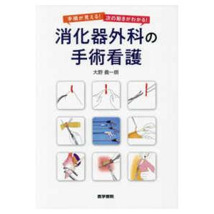 手順が見える 次の動きがわかる 消化器外科の手術看護