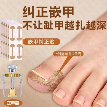 🔥隔日到貨 緩解疼痛👍甲溝炎矯正 凍甲 正甲貼片 卷甲矯正器 凍甲矯正器 腳趾甲貼片 甲往肉裏長 卷爪 嵌甲