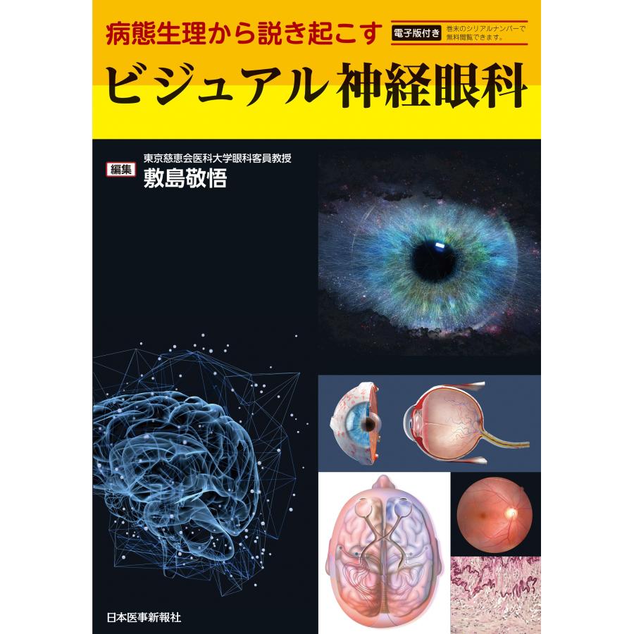 病態生理から説き起こす ビジュアル神経眼科 -電子版付-