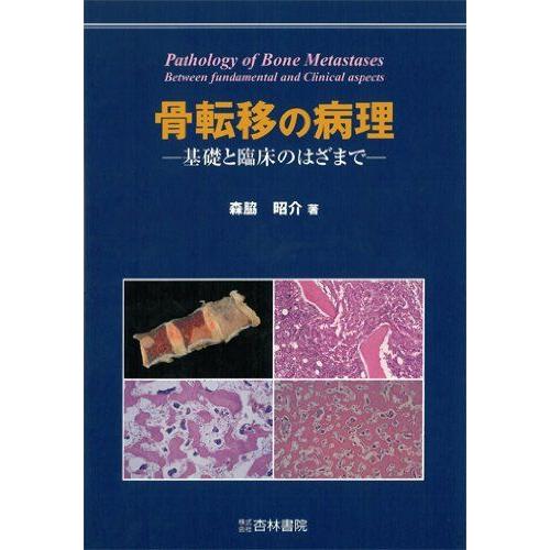 [A12182288]骨転移の病理―基礎と臨床のはざまで