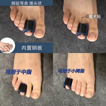 超舒服✨腳趾矯正器 拇指外翻 腳趾固定器食指錘頭趾弓趾抓地矯正器肌腱短萎縮彎曲重疊內扣