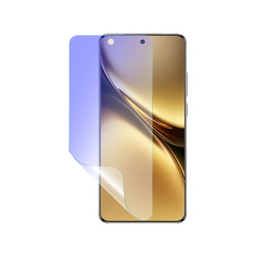 o-one vivo X200系列 護眼螢膜PRO 全新升級 抗藍光螢幕保護貼 輕微刮痕自動修復
