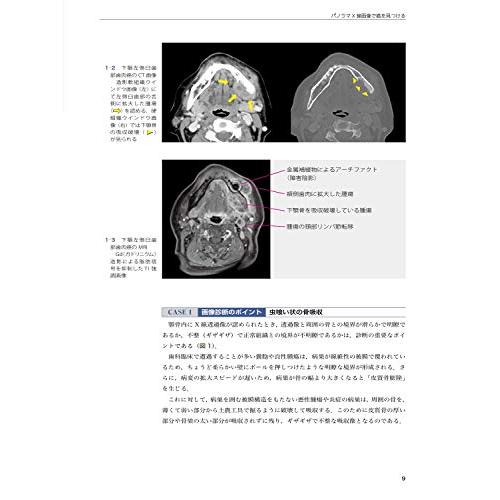 歯科臨床画像診断のチェックポイント