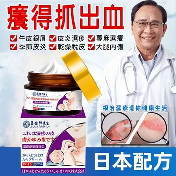 台灣出貨🥇日本技術🥇日本止癢乳膏 濕疹止癢 止癢膏30g皮膚瘙癢 溫和皮炎  皮膚癢 皮膚脫皮 皮膚膏