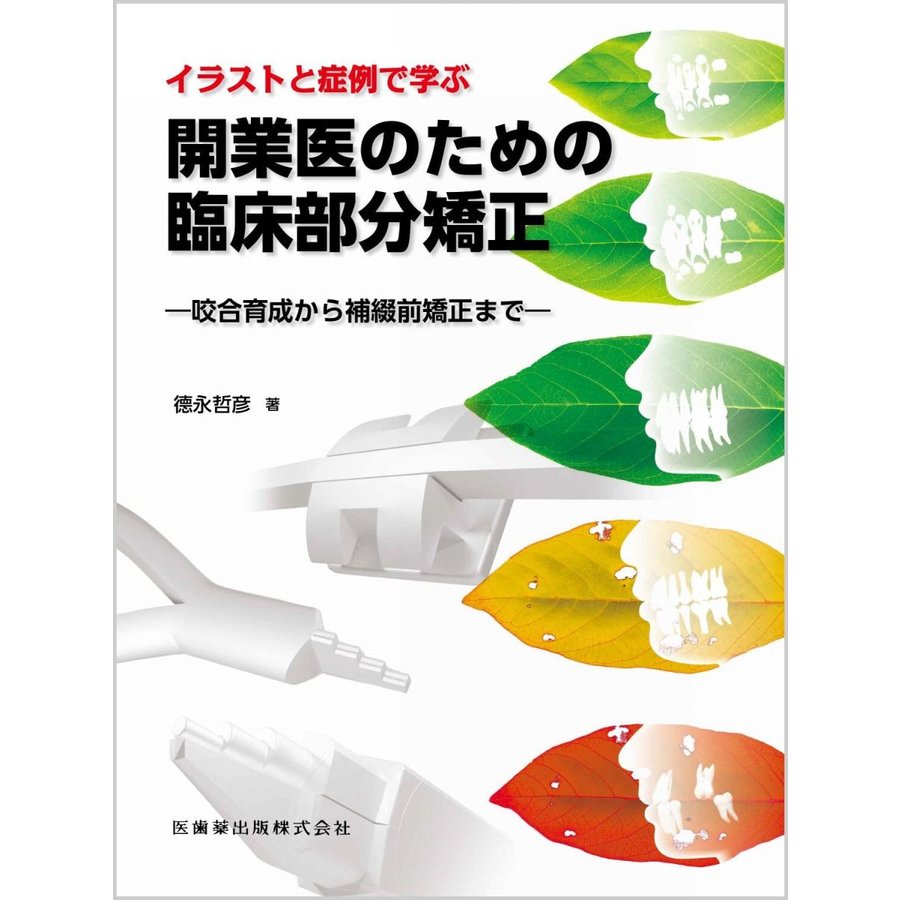 イラストと症例で学ぶ 開業医のための臨床部分矯正 咬合育成から補綴前