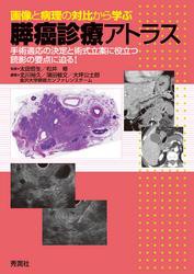 画像と病理の対比から学ぶ膵癌診療アトラス 手術適応の決定と術式立案に役立つ読影の要点に迫る