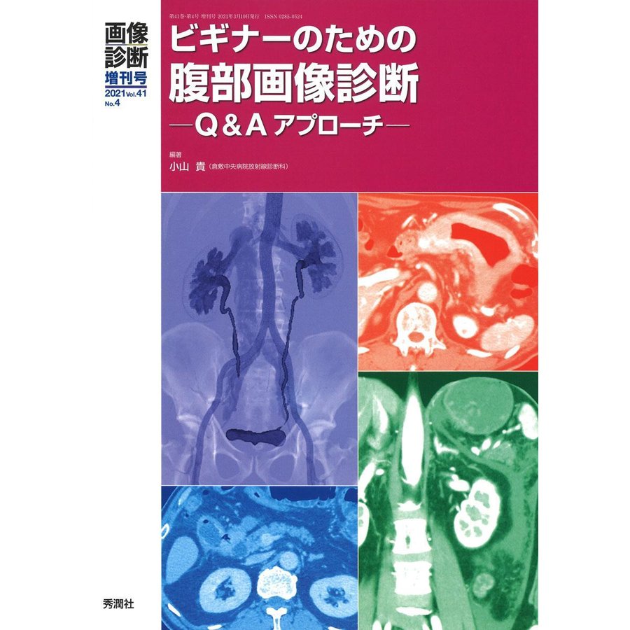 画像診断2021年増刊号 ビギナーのための腹部画像診断 Q Aアプローチ