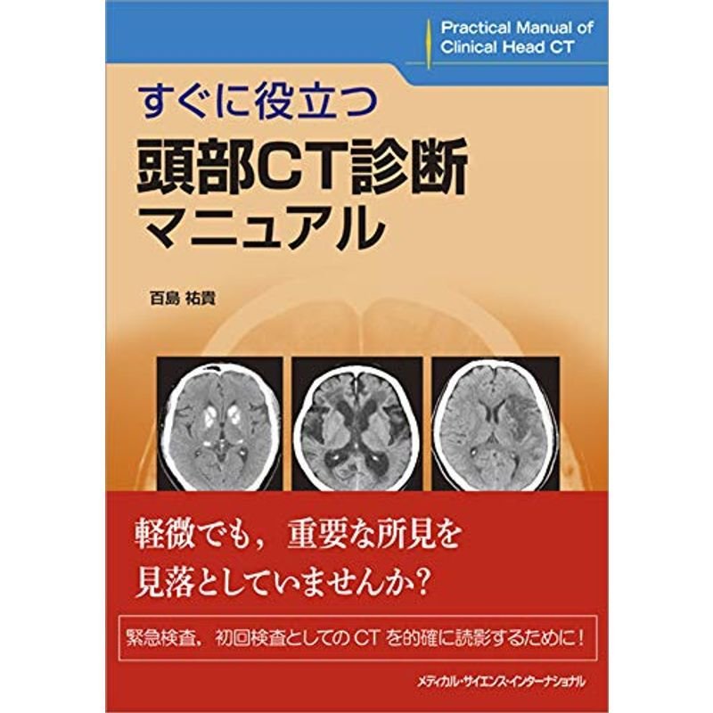 すぐに役立つ頭部CT診断マニュアル