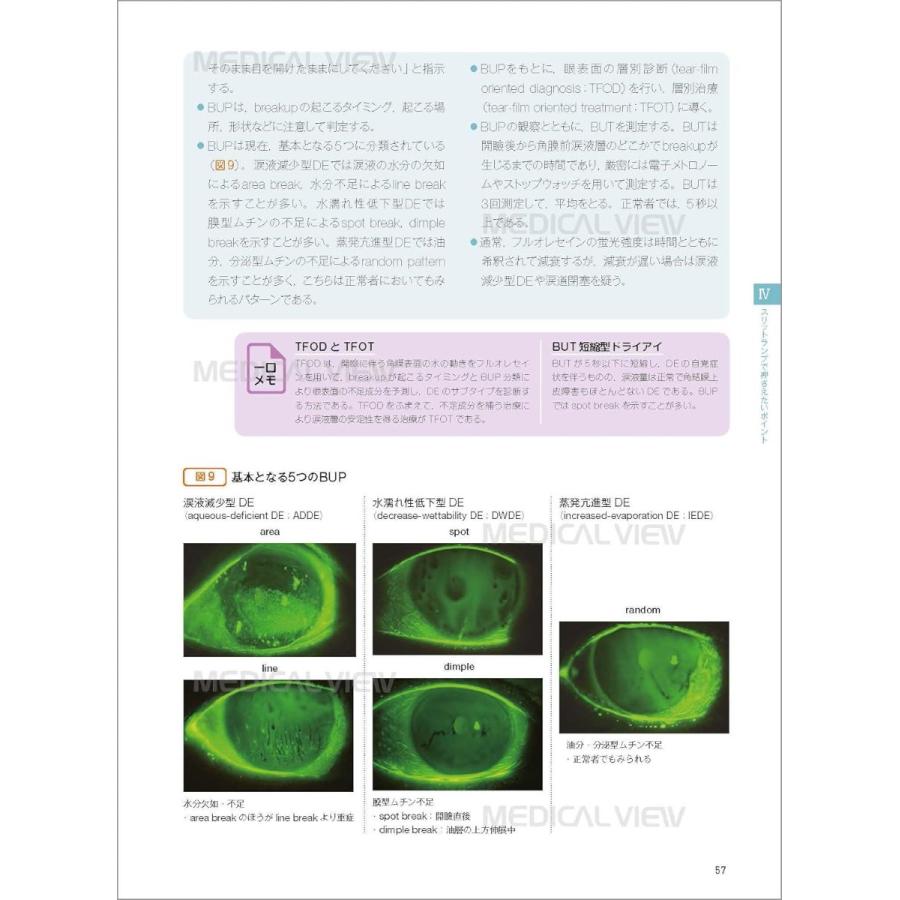 新 眼科診察クローズアップ