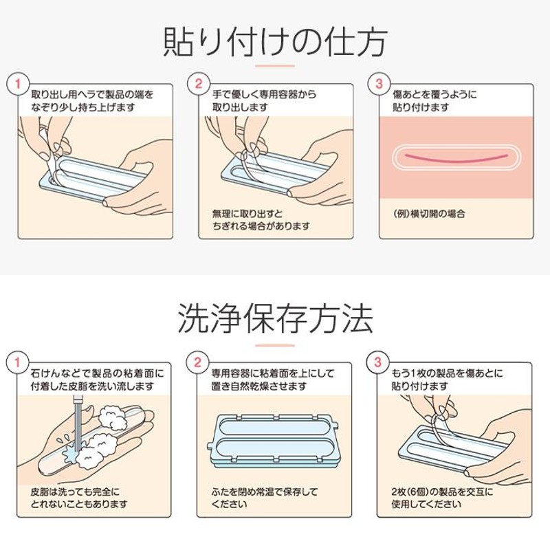 帝王 切開 傷 テープ トップ シリコン